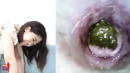 BFH-176 04 Her most embarrassing hole. VOL. 6