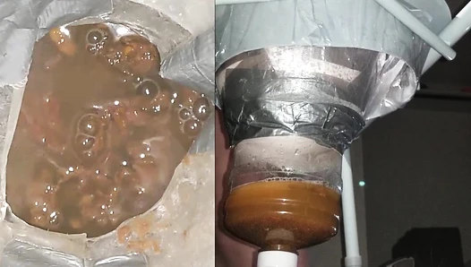 SSBBW Queen Siya - WEIRD ENEMA 7 + BLENDED CARROT MEAL
