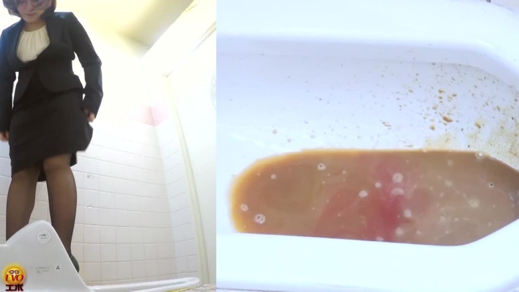 EE-596 05 Excretion diaries of office ladies: healthy poops and diarrhea.