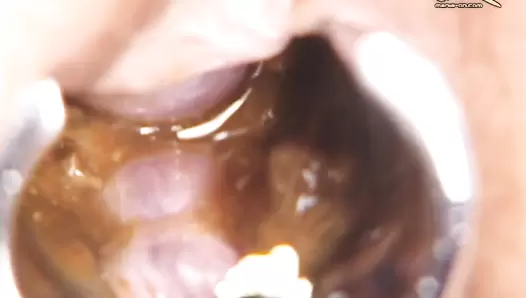 UNKW-063 04 Close-up shots of female defecation! Remastered Exodus Gold and OPERA series. (Uncensored) #5